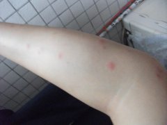 ݡӦôעʳ?