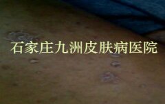 ţƤѢڷҩʱЩע