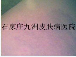 ʪβԭЩ?