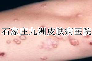 ڵıƽܷʹҩס?
