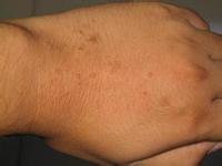 ƽƲܳhpv?