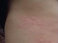 ݡڻʱѡʲôҩ?