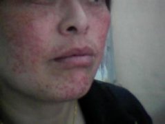 бƽ໼Ϊhpvʲô?
