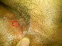 ʪĲʹʲôҩԳ׵?
