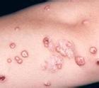 ƽ໼βܱhpvܹ׵ʧ?