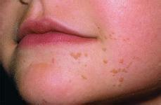 ƽʹüǲܹhpv?