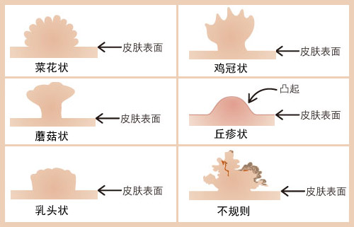 ʪ缲Ҫ緢