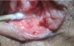 ʪʲôԳ׵ĸhpv?