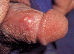 ʪЧܳ׸hpv?