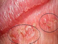 ʪôܳ׵ĳhpv?