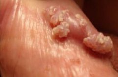 ʪܳ׸hpv?