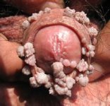 ʪhpvܲܳ׵ĸ?