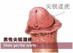Щʪิ?