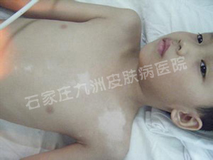沿Ʒôѡ