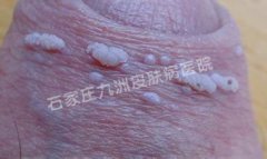 ʪƻѺЩ?