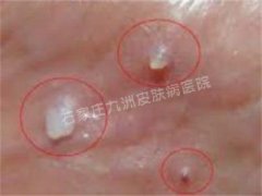 ʪȥhpv?
