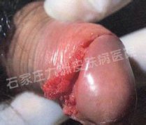 мʪӦȷѡ񷽷?