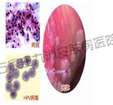 ʪƲȥhpv?