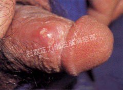  ʪʵҼ鷽ʡǮ?