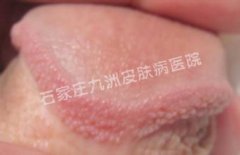 ڼʪ᲻ʹѪ?