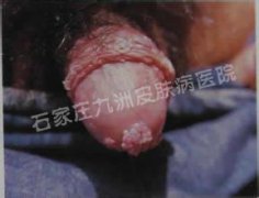 ʪ෢֢״ʱв?