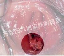 ٴʪhpv?