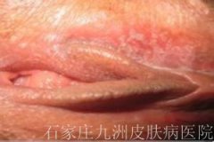 ʪ໼ڼӦεʳ?