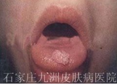 ǻʪȾļƺ?