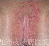 ʪȷҪЩ?