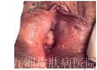 ʪǸʲôԭ?