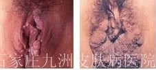 ӦԤƼʪ?