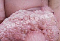 Լʪ֢״Ʋ?