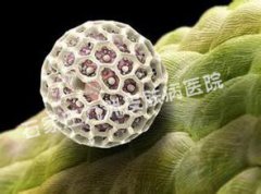 ʪַhpv?
