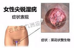 ʪøȥhpv?