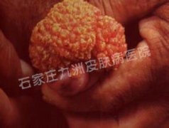 ʪǱڹЩ֢״?