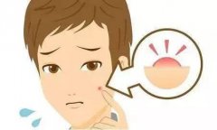ഺԤʩ?