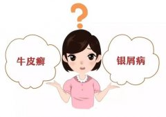 ţƤѢǰӦϼȷﲡ?
