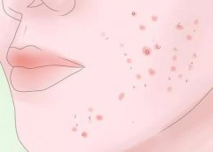ƽǸʲôԭµ?