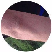 ݡӦԤЧķ?
