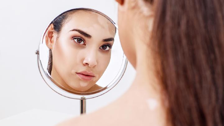 白癜风应当如何检查出来呢?