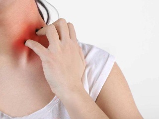 湿疹临床上常见的典型损害有哪些?