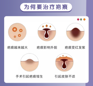 生活中哪些疤痕情况需要注意呢?