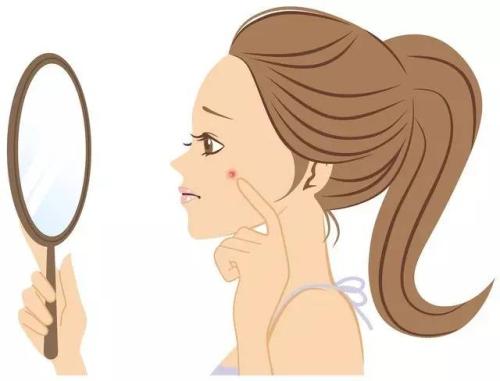 痘印都有哪些具体的类型和表现?