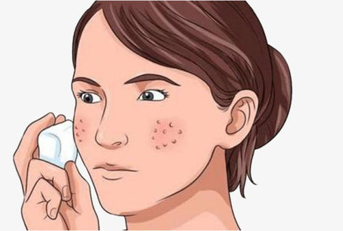 黄褐斑都是什么原因导致的?