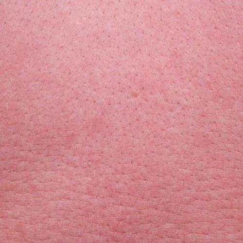 为什么你的皮肤容易过敏呢?