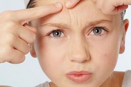 青春痘为什么不建议挤掉呢?