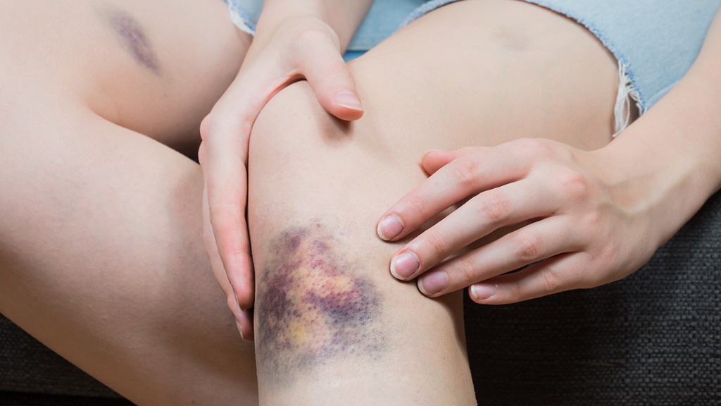 神经性皮炎会引起关节疼痛吗?