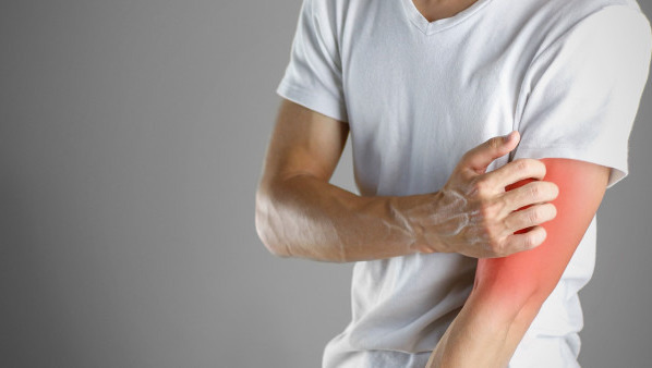 神经性皮炎好了之后会留疤吗?