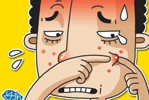 痤疮会引起脸上出现浮肿吗?