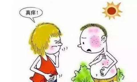 日光性皮炎会引起皮肤脱皮吗?